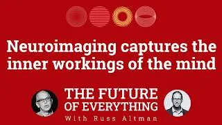 Thumbnail: The future of neuroimaging