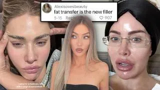 Thumbnail: fat transfer is the new fillers
