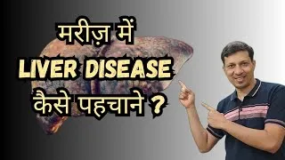 Thumbnail: 5 Clinical Signs of Liver Disease Every Doctor Should Recognize | मरीजमें Liver disease कैसे पहचाने?