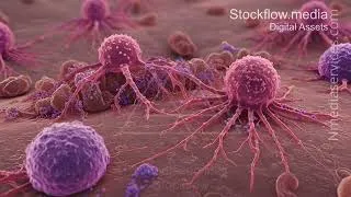 Thumbnail: Metastatic | Cancer Cell | Microscopic - 4K Stock Footage
