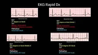 Thumbnail: Medical Student Review: Cardiology Preclinical Review