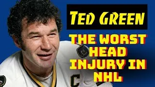 Thumbnail: Ted Green: The Most Severe Head Injury in NHL History