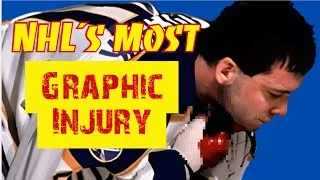 Thumbnail: Clint Malarchuk: The Most Graphic Injury in NHL History | A Slashed Throat on Live TV