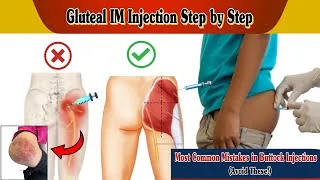 Thumbnail: Buttock Injection Explained: Proper Technique & Safety Guide