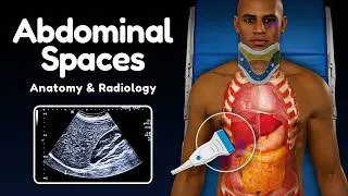 Thumbnail: Abdominal Spaces (Peritoneal, Retroperitoneal & Pelvic Spaces)