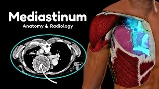 Thumbnail: Mediastinum (Compartments, CT Anatomy & Masses)