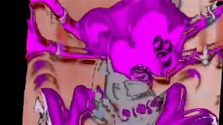 Thumbnail: Robotnik Gently Caresses an Ape