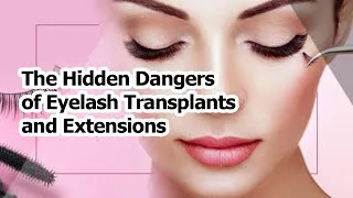 Thumbnail: The Hidden Dangers of Eyelash Transplants and Extensions