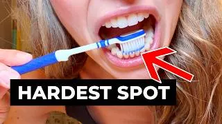 Thumbnail: 5 Places You’re Missing When You Brush