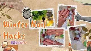 Thumbnail: Dry Nails in Winter? ❄️ Try These Easy Nail Care Hacks | Corporate Girl Self Care Vlog