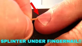 Thumbnail: TRY NOT TO LOOK AWAY CHALLENGE!! **SPLINTER EDITION**