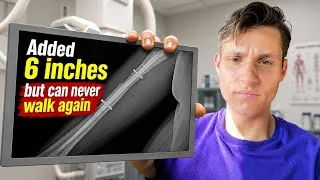 Thumbnail: The Downsides of Looksmaxxing 