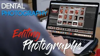 Thumbnail: Dental Photography Basics - Editing Dental Photos