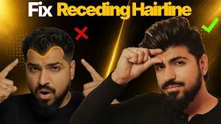 Thumbnail: Receding Hairline? 7 Practical Ways to Regrow Hair Naturally | Sahil Gera