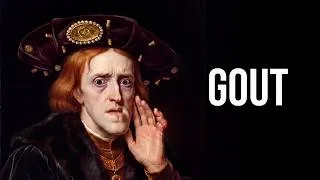 Thumbnail: The Grotesque Death Of The Most Powerful Habsburg Emperor