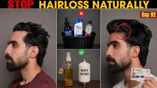 Thumbnail: I SAVED my HAIRLINE at 35: No Minoxidil | Stop hairloss Naturally | Hairfall | Receding hairline