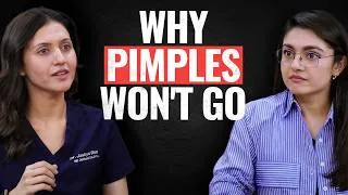 Thumbnail: Dermatologist Explains Why Acne Won't Heal on Indian Skin| Dr Jushya Bhatia Sarin