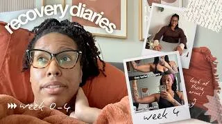 Thumbnail: RECOVERY DIARIES: LOOSE SKIN REMOVAL |  ARM + BREAST LIFT AFTER 70LB WEIGHT LOSS | WEEK 0-4 | VLOG