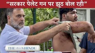 Thumbnail: Rahul Gandhi on Pellet Gun: सरकार सच छिपा रही है?