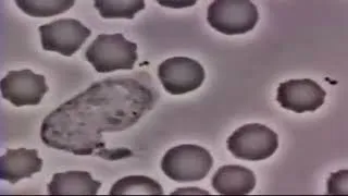 Thumbnail: the ting goes jenny sparks remix WITH ACTUAL BACTERIA