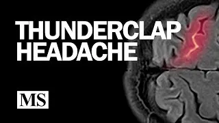 Thumbnail: Thunderclap Headache