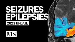 Thumbnail: Seizures and Epilepsies (2023)
