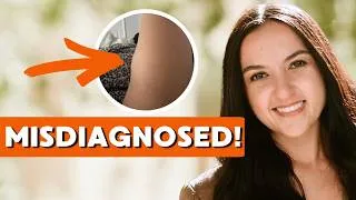 Thumbnail: Doctors Thought It Was A Benign Lipoma… It Was Rare Cancer "I thought it was a muscle injury"