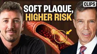 Thumbnail: What Your CT Angiogram Misses (And Why Soft Plaque Is Riskier) | Dr. Campbell Rogers
