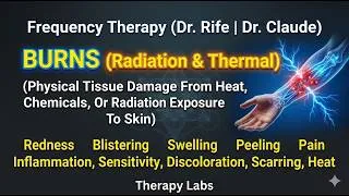 Thumbnail: BURNS (Radiation & Thermal)  Rife Healing Frequencies | 30-Min Therapy Session | TherapyLabs