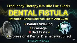 Thumbnail: DENTAL FISTULA healing frequencies  |  #Rife #Clark  |  30 Mins (NO ADS)