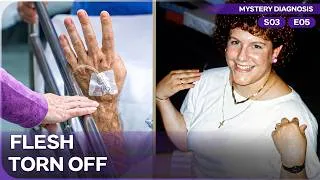 Thumbnail: The Tiny Scab That Triggered A Deadly Immune Attack | Mystery Diagnosis Season 3 Episode 5