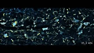 Thumbnail: Watch Lysosomes Remodel the Endoplasmic Reticulum in C. elegans