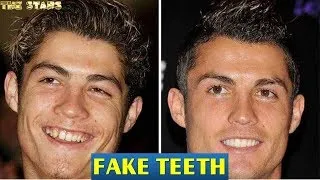 Thumbnail: 30+ Celebrities With Fake Teeth  ★2018