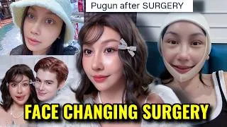 Thumbnail: PUGUN WISAD BEFORE & AFTER FACE SURGERY: INTERNET CELEBRITIES BEING OBSESSED WITH LOOKING SNATCHED