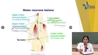 Thumbnail: Topic : Extrapyramidal Tracts - Part II