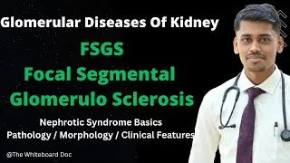 Thumbnail: FSGS Focal Segmental Glomerulo Sclerosis l Pathology Of Nephrotic Syndrome l BASICS Bases on Robbins