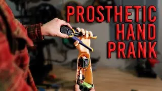 Thumbnail: Making a Prosthetic Hand as a Prank