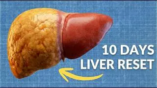 Thumbnail: How To Reverse A Fatty Liver & Drop Visceral Belly Fat In 10 Days