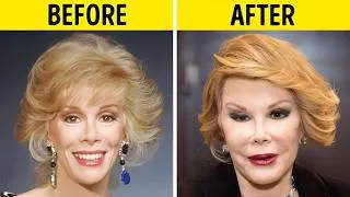 Thumbnail: 75+ Celebrity Plastic Surgery Disasters | Before and After