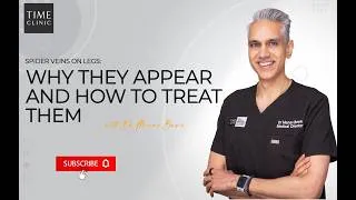 Thumbnail: Spider Veins on Legs: Why They Appear and How to Treat Them