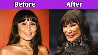 Thumbnail: 50+ Celebrities Before and After Plastic Surgery! 😱