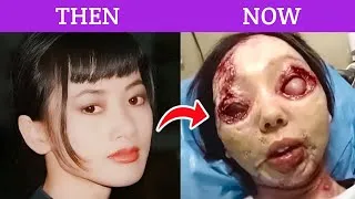 Thumbnail: You Won’t Recognize These Stars After Their Plastic Surgery! 😱 #2 