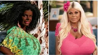 Thumbnail: 20 Celebtrities Who Regretted Changing Their RACE With Surgeris