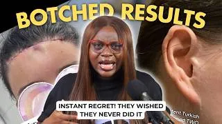 Thumbnail: People Are REGRETTING Their Cosmetic Procedures BIG TIME!
