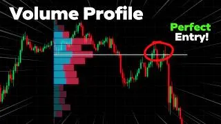 Thumbnail: The ONLY Volume Profile Trading Guide You NEED In 2026!