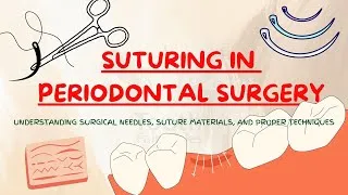 Thumbnail: Suturing in Periodontal Surgery , Part 1