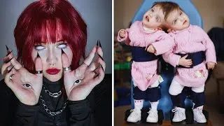 Thumbnail: 15 Unusual People, You Will Regret If You Don’t See Them...