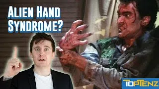 Thumbnail: 10 Terrifying Diseases You've Never Heard Of