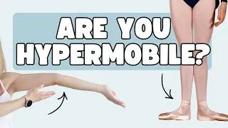 Thumbnail: Signs You Might Be a Hypermobile Dancer