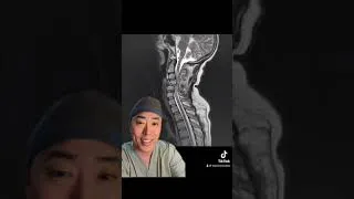 Thumbnail: Neurogenic Shock: Pathophysiology & Therapy